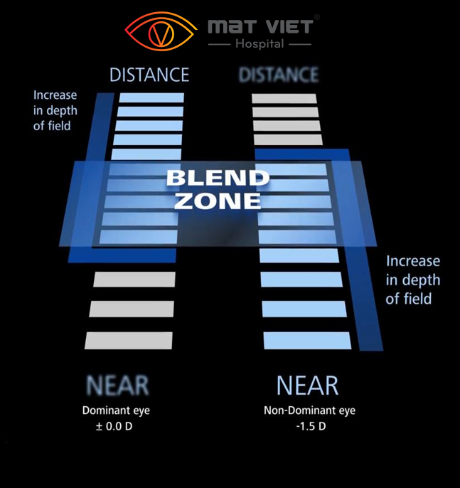 Hình 1: “vùng tiêu cự trung gian" (Blend Zone) ở khoảng cách trung gian