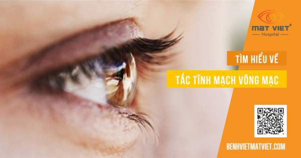 Tac Tinh Mach 1200x630 (1)