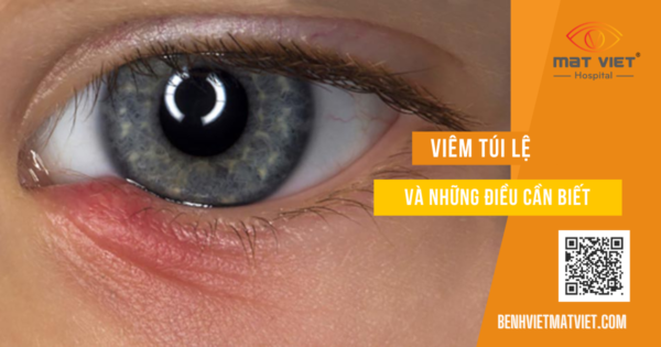 Viêm túi lệ