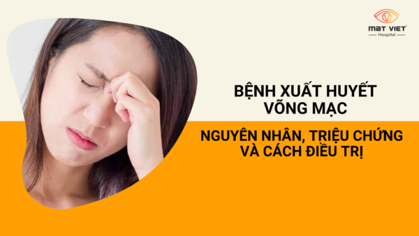 Xuat Huyet Vong Mac 00