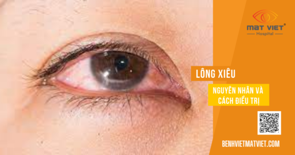 Long-xieu