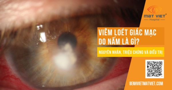Viem Gm Do Nam (1)