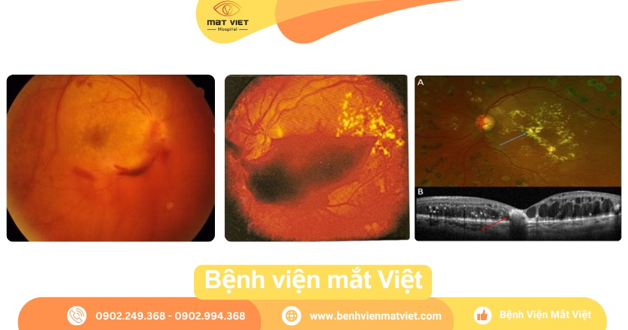 Hình: Mâm cỗ ngày Tết có thể ảnh hưởng sức khỏe.