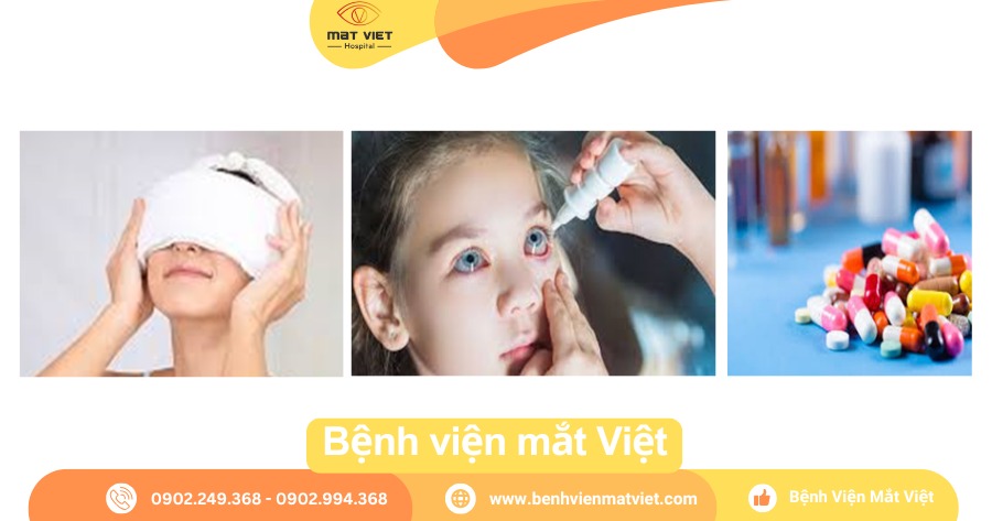 Các biện pháp giảm phù kết mạc.