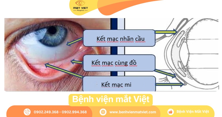 Cấu tạo giải phẫu kết mạc và củng mạc (tròng trắng).