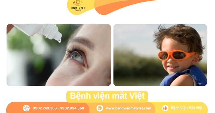 Nhỏ mắt và đeo kính râm bảo vệ mắt.
