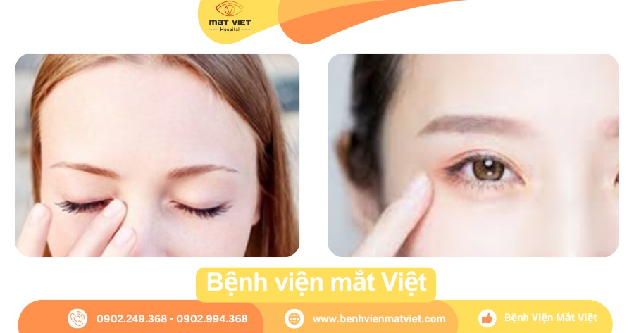 Ngứa khóe mắt