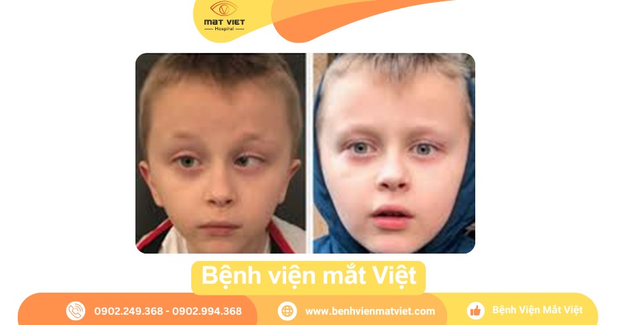 Trước và sau khi đã phẫu thuật chỉnh lé