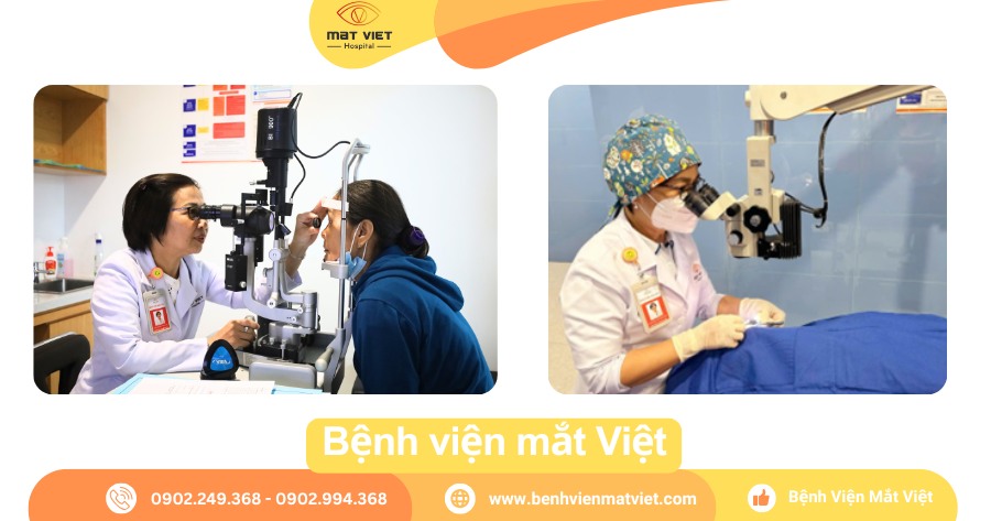 Khám và xử lý keo 502 vào mắt tại BV mắt Việt.