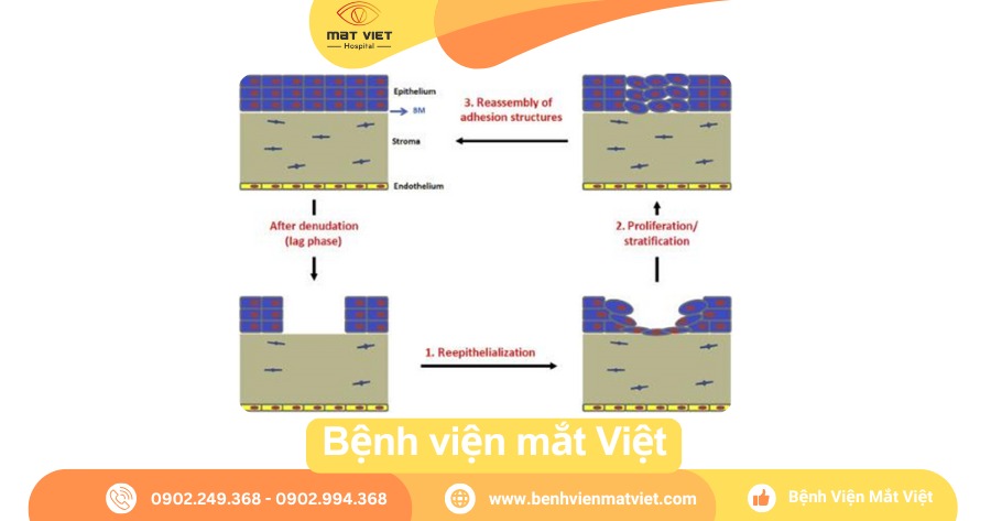 Quá trình lành vết rách giác mạc nông.