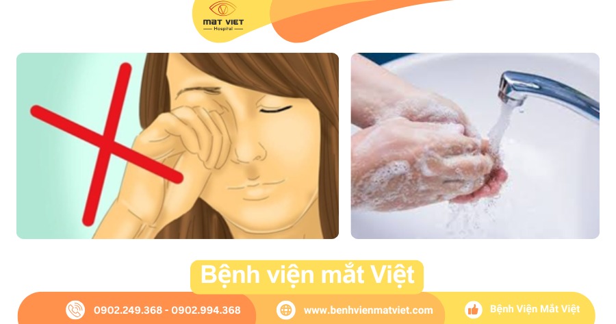 Hình: Nên và không nên khi mắt bị ghèn.